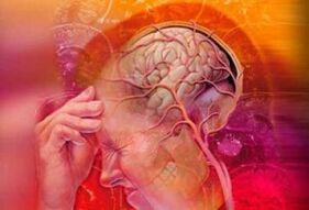 Syndrome de migraine cervicale