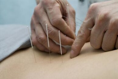 Acupuncture pour l'ostéochondrose de la région thoracique